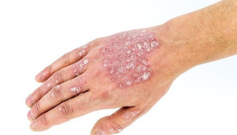 How Do You Find the Right Skin Care Solution in Orange County?